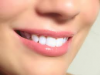 alta white teeth'