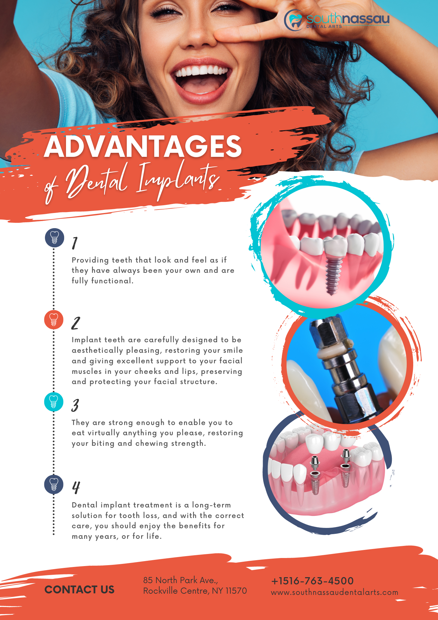 Advantages of Dental Implants'