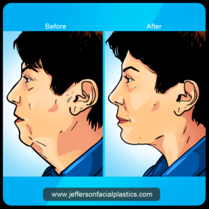 Jefferson Facial Plastics'