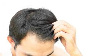 Hair Loss Treatment Products Market