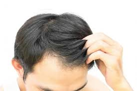 Hair Loss Treatment Products Market'