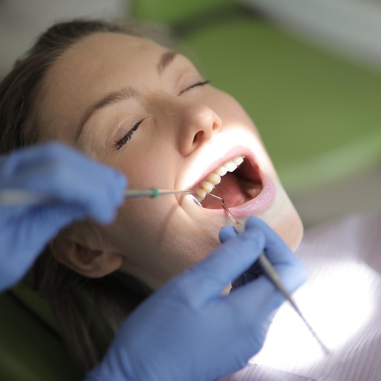 Help from Miami Dentist to Carefully Remove Mercury Fillings