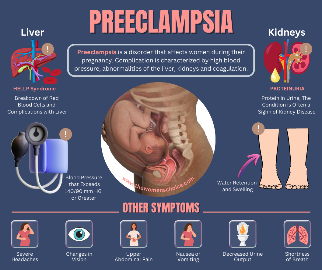 Preeclampsia'