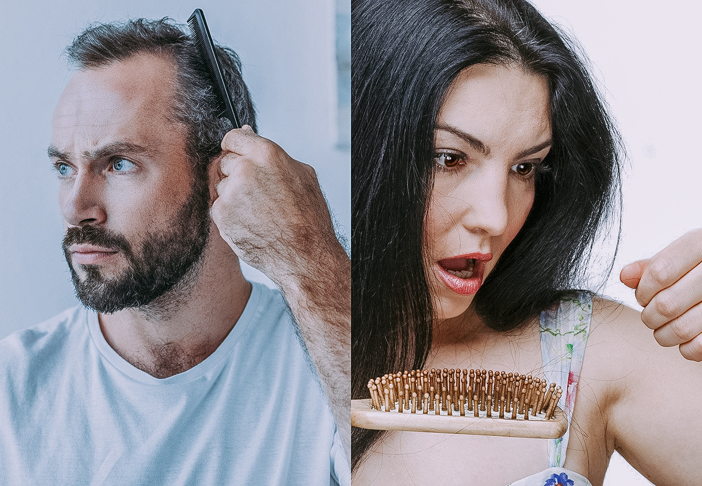 Hair Loss Men and Women Market'