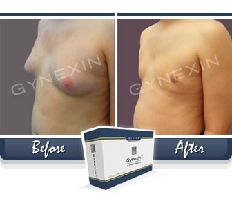 Gynexin User Pics'