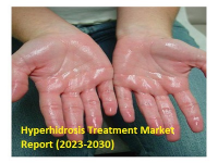 Hyperhidrosis Treatment Market