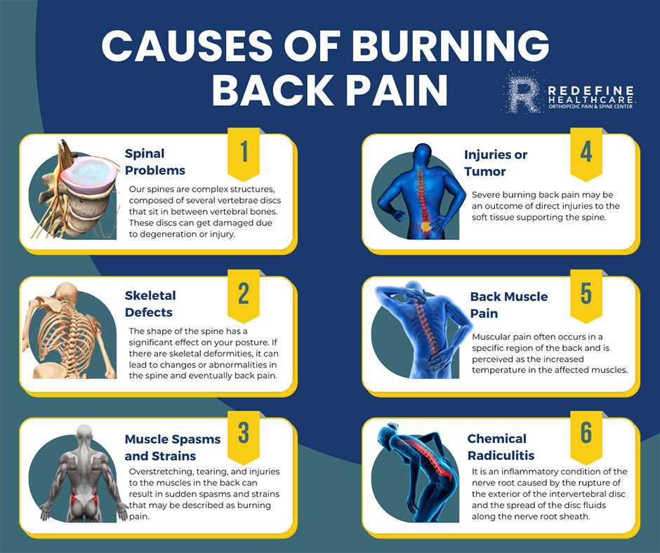 What Causes Burning Back Pain'