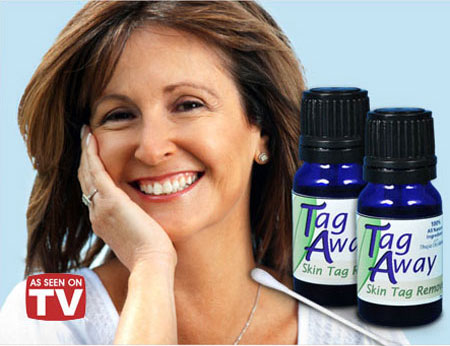 Official Tag Away Skin Tag Remover'