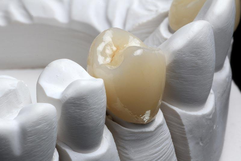 Dental Lab in Glendale AZ'