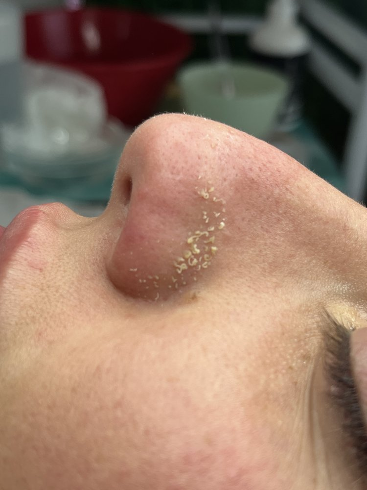 Esthetician Hollywood FL'