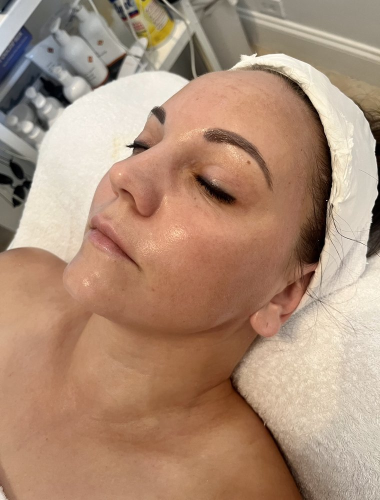 Best Facial Hollywood FL'