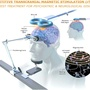 Stroke Recovery Project'