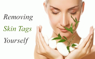 Revitol Skin Tag Removal'