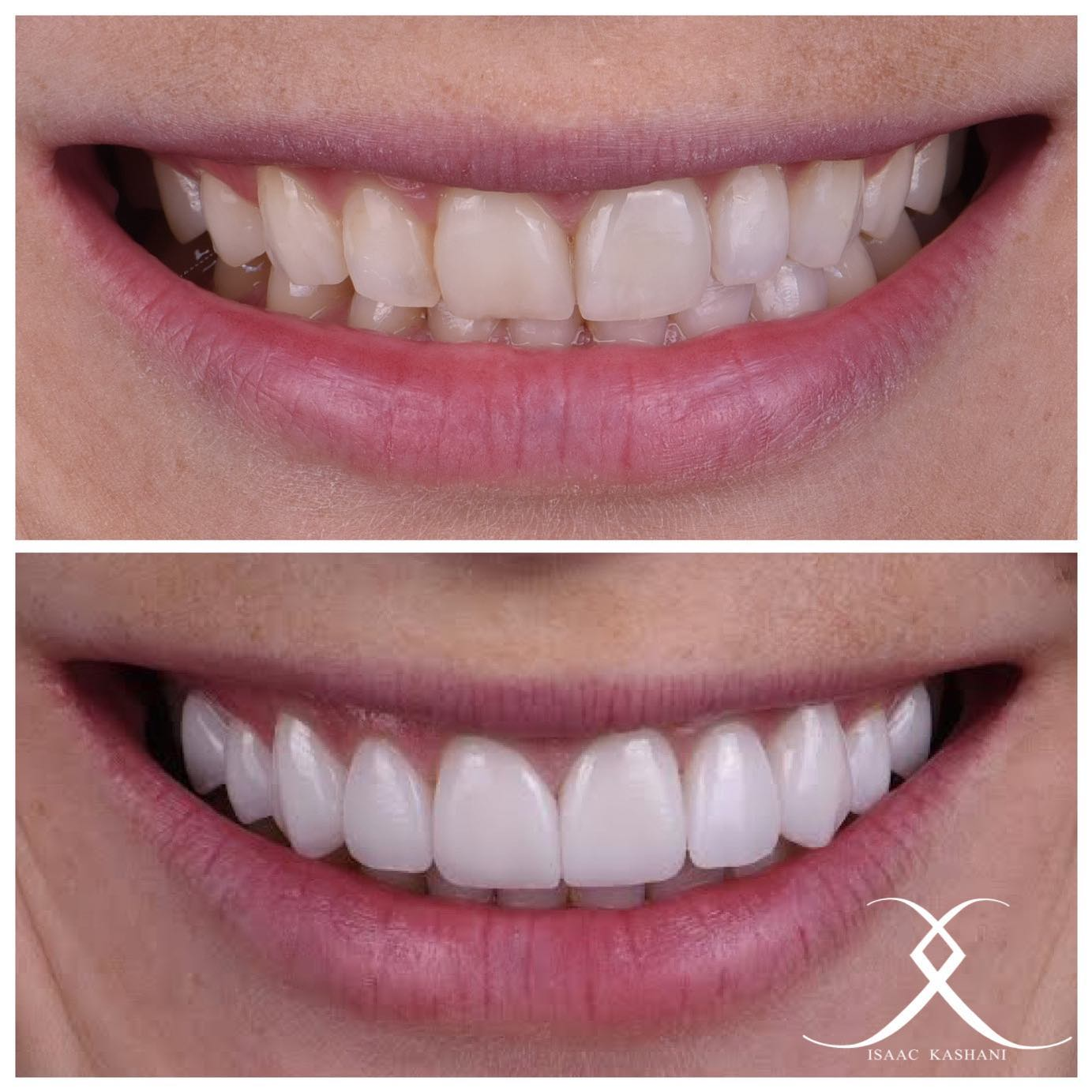 Company Logo For Lasting Impressions Dental Spa'