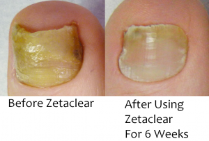 ZetaClear Review'