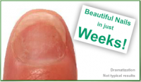Kill Nail Fungus'