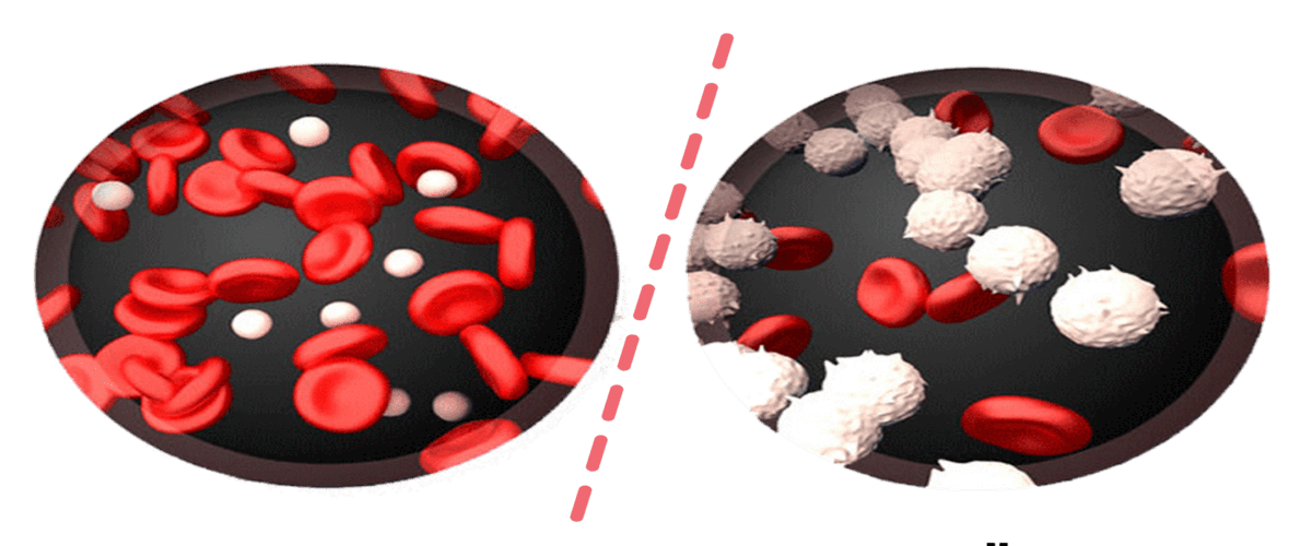 Blood Cancer Detection Market