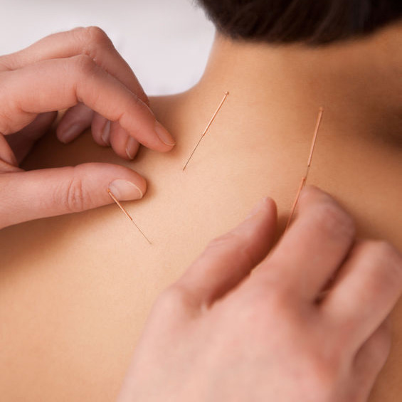 Certified Acupuncturist'