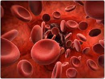 Hemoglobinopathies Market'