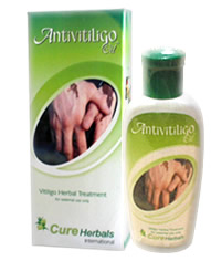 Anti Vitiligo Oil'