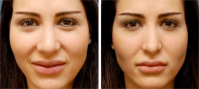 The Institute for Rhinoplasty and Nasal Reconstruction'