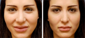 The Institute for Rhinoplasty and Nasal Reconstruction