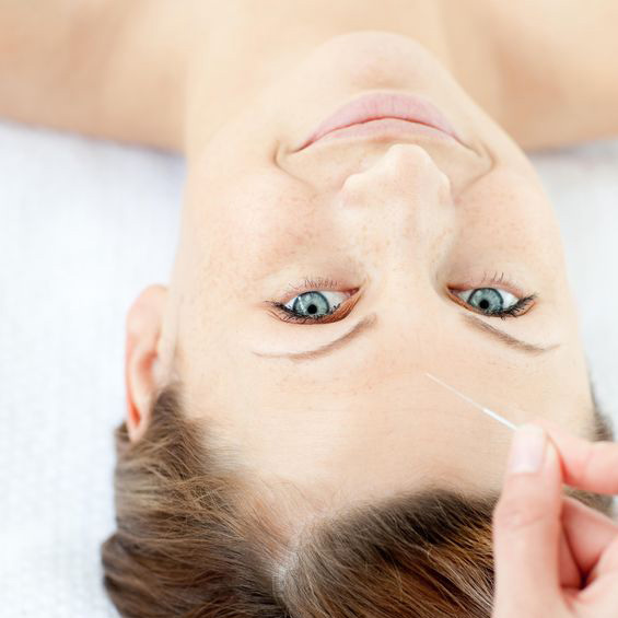 Facial Acupuncture'