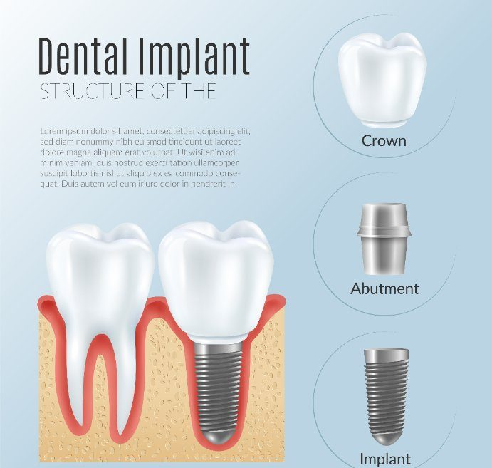 Emergency Dental Treatment'