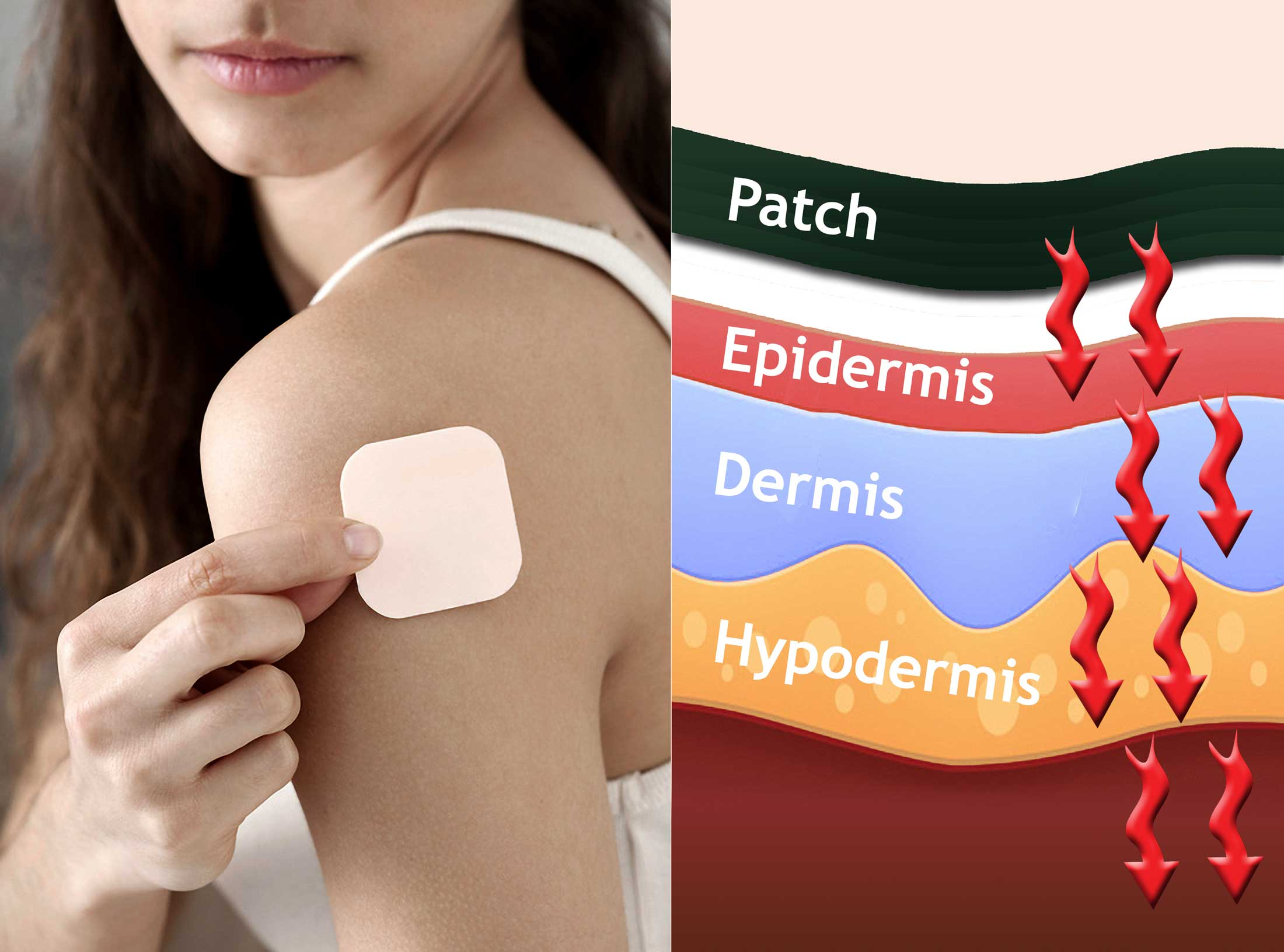 Transdermal Drug Patches Market'