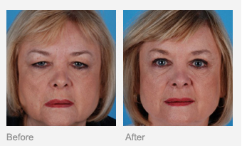 Jefferson Facial Plastics