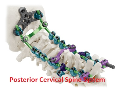 Posterior Cervical Spine System Market'