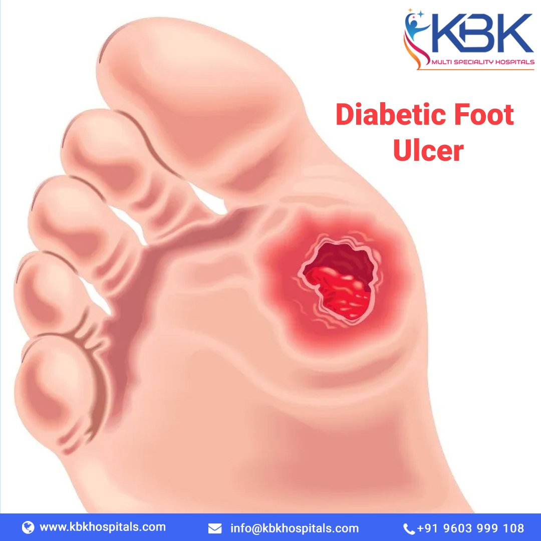 Company Logo For Diabetic Foot Care Clinic in Hyderabad'