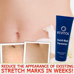 Stretch Mark Cream'