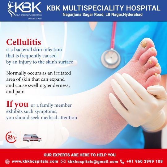 Company Logo For Cellulitis Specialist Doctor in Hyderabad'