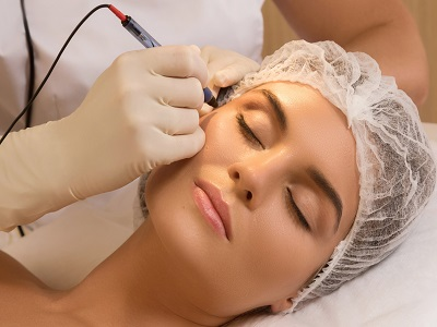 Cosmetic Laser Market