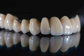 Dental Ceramics Market