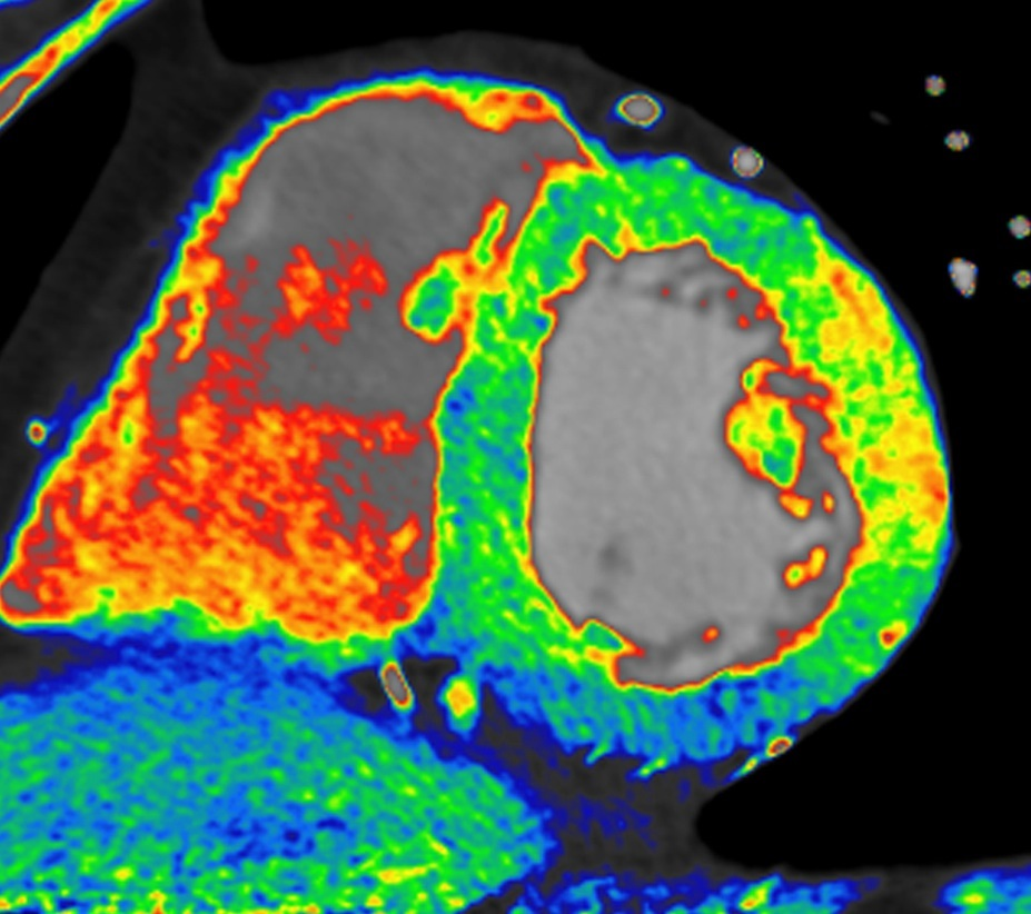 Angiography Software Market'