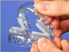 Snoring Mouthpieces'