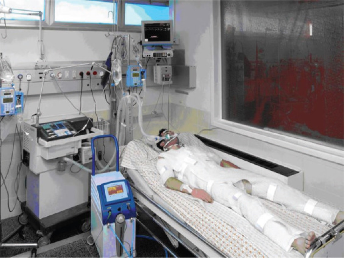 Therapeutic Hypothermia Systems Market'