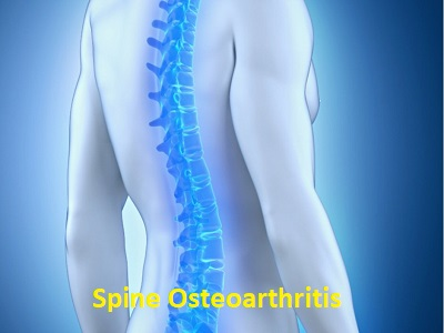 Spine Osteoarthritis Market'