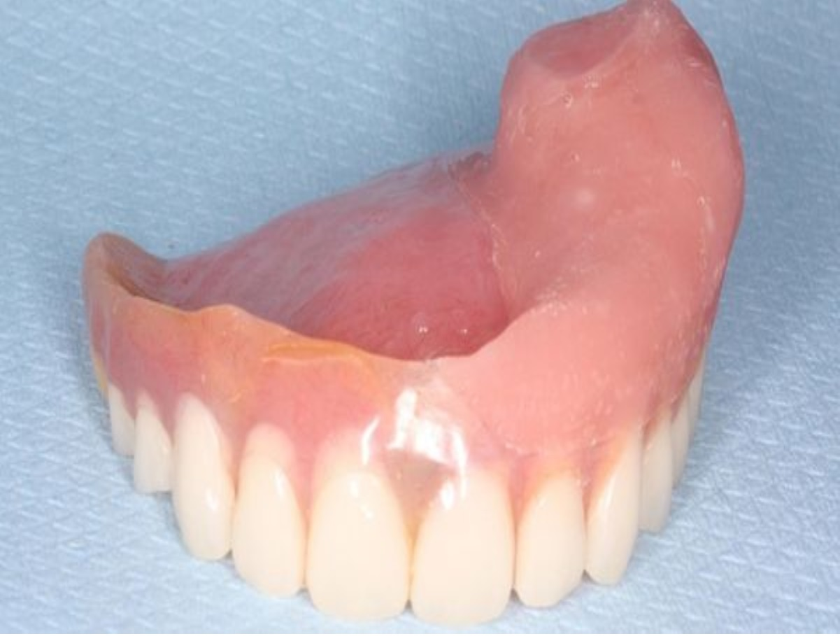 Dental Obturators Market'