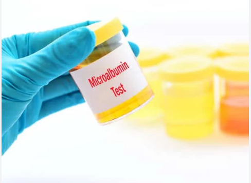 Microalbumin Test Market'