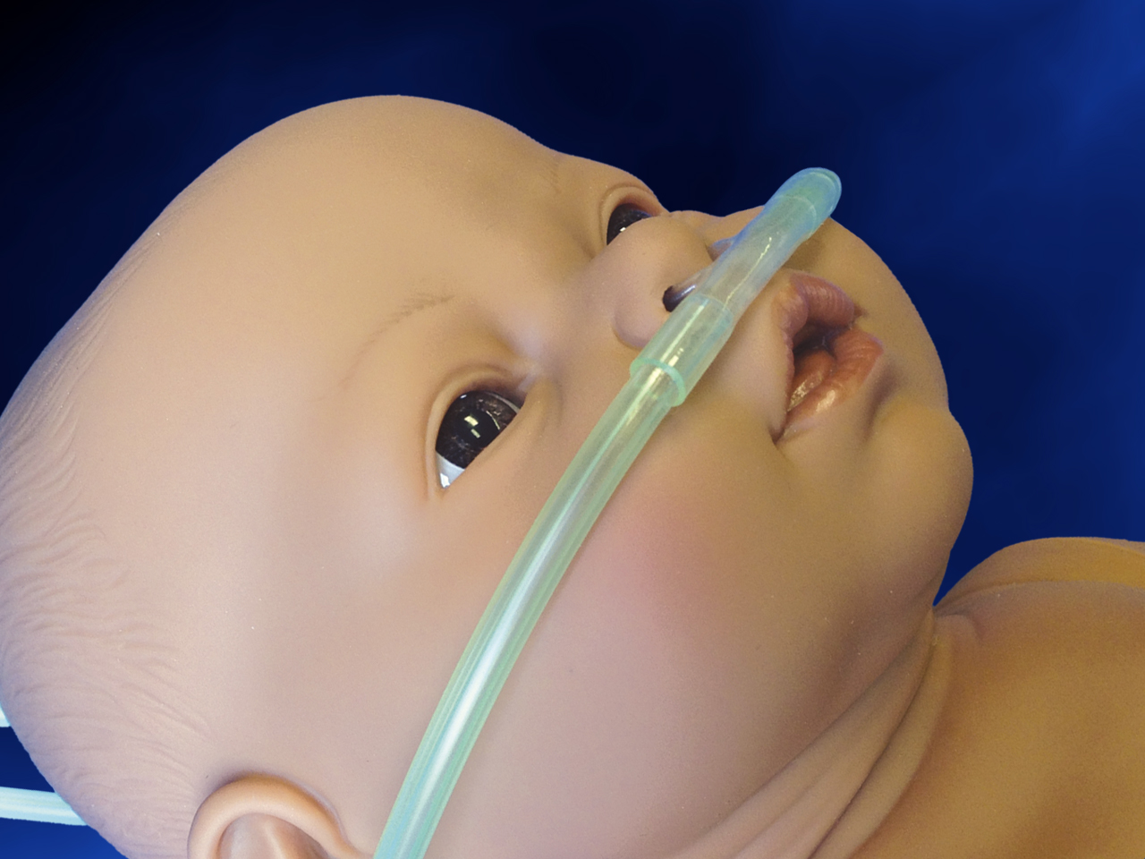 Nasal Cannula Market'