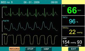 Medical Monitor Market'