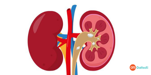 Company Logo For Best Kidney Treatment in India'