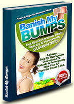 Keratosis Pilaris Treatment - 5-Day Cure Revealed