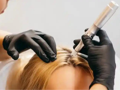 PRP Treatment in Lucknow - The Velvet Skin Centre'