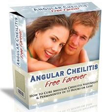 Angular cheilitis treatment'