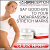 Skinception Stretch Mark Cream CTA'