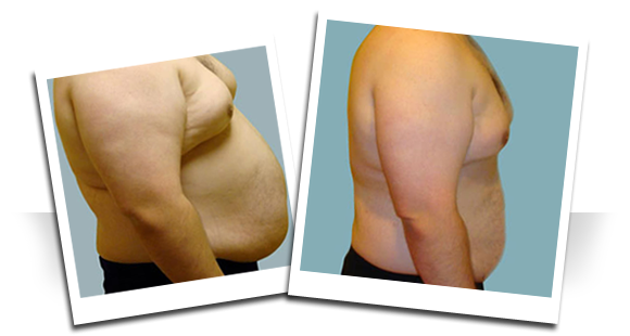 Grreen Coffee Bean Max Vs GCB Max'